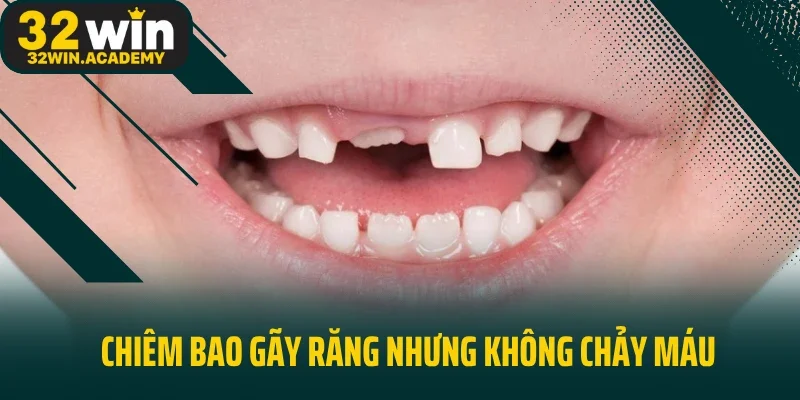 Chiêm bao gãy răng nhưng không chảy máu